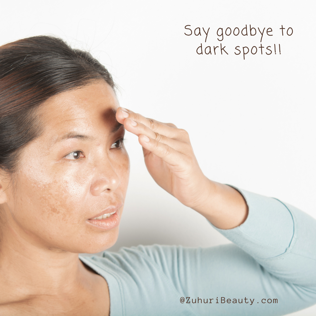Help! Why won't my dark spots go away?