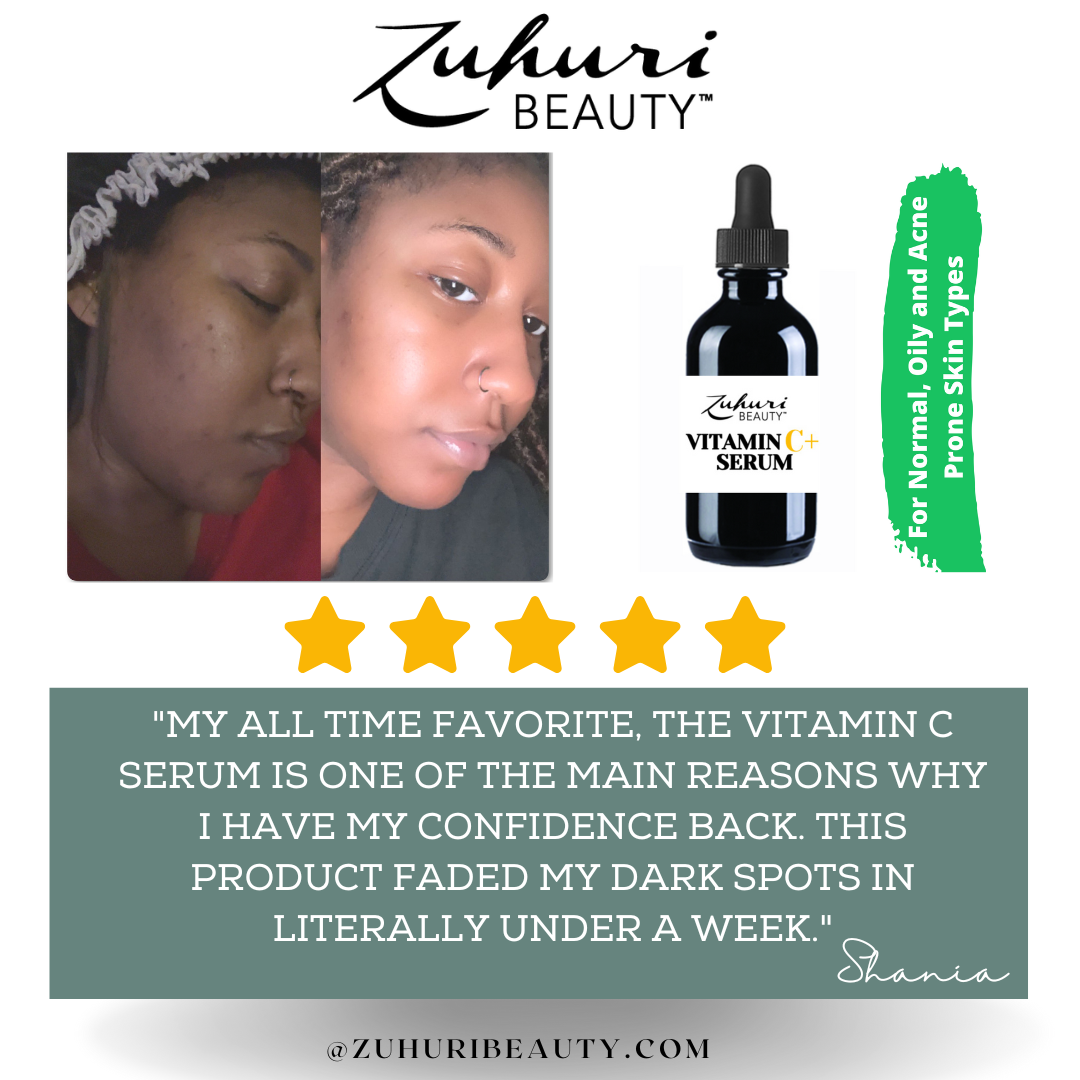 Dark Spot Solution for brown skin, Hyperpigmentation, acne scars, dark spot removal for brown skin