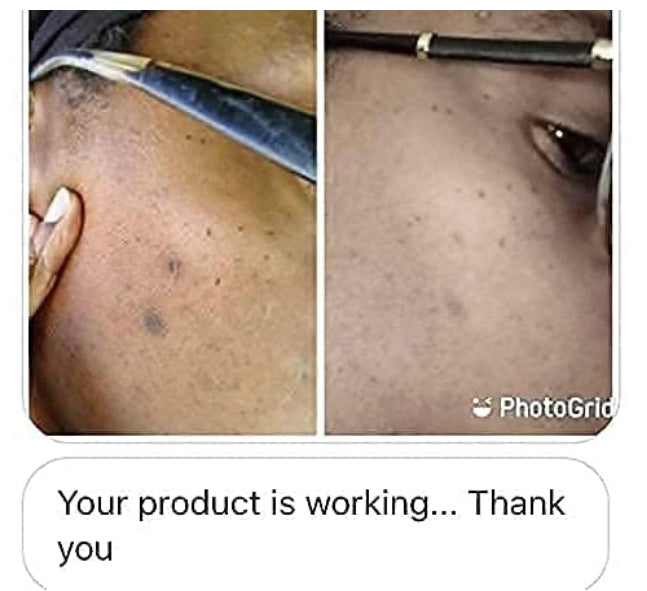 
                  
                    Vitamin C+ Serum Lightens Dark Spots and Heals Damaged Skin
                  
                