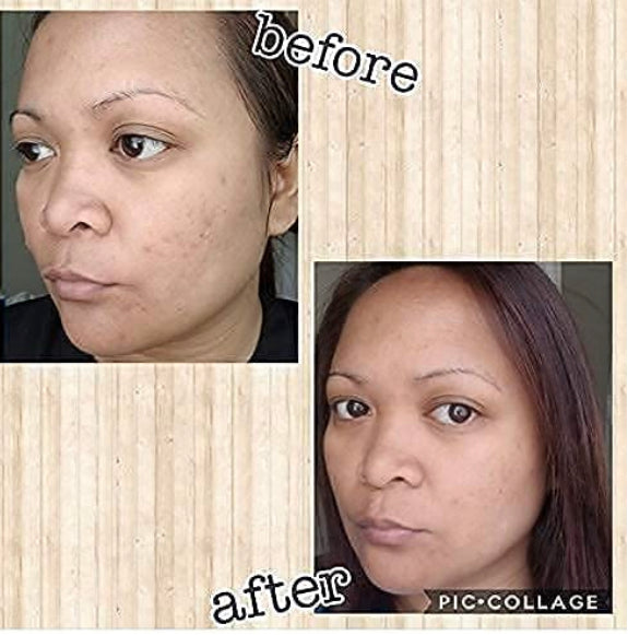 
                  
                    Vitamin C+ Serum Lightens Dark Spots and Heals Damaged Skin
                  
                