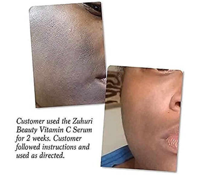 Vitamin C+ Serum Brightens, Lightens and Revives Dull Skin