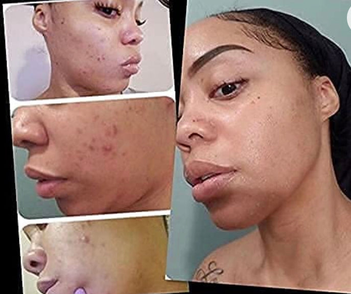 Vitamin C+ Serum Brightens, Lightens and Revives Dull Skin